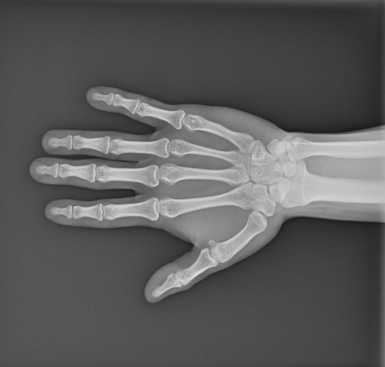 Radiografía digital de mano tomada en el Centro Médico Vital Pastora